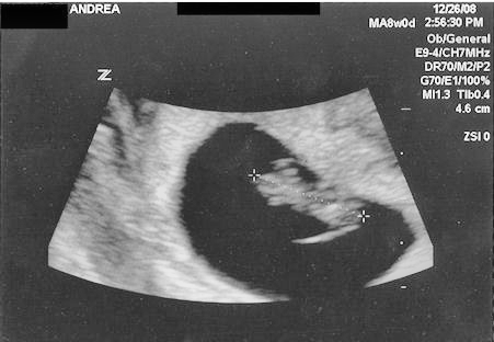 8 weeksit looks like an ultrasounds at 8 weeks. 8 weeksit looks like an