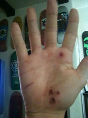 hand holes skateboarding